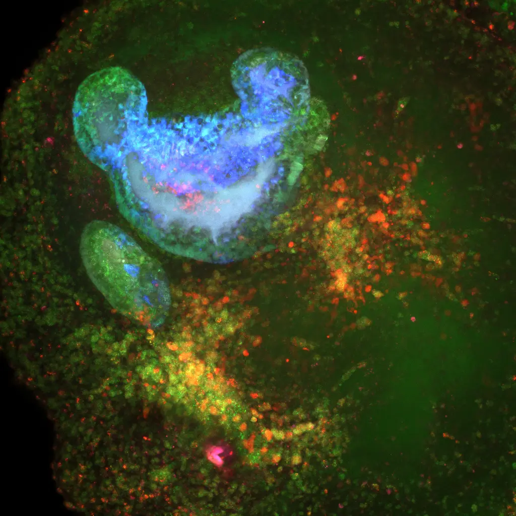 A second day-20 hemogenic gastruloid imaged by HCR FISH